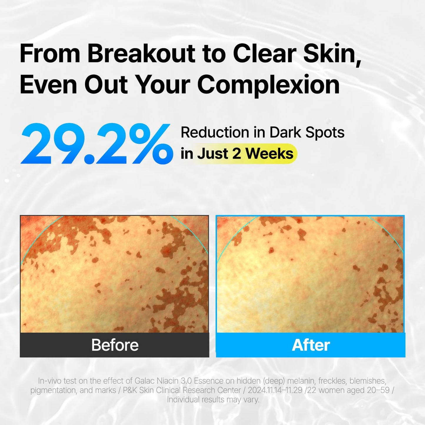 ma:nyo Galac Niacin 3.0 Essence 30ml-Wonder Skin