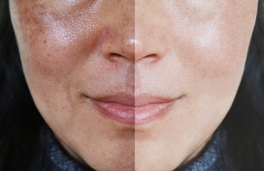 Die 10 besten koreanischen Seren gegen Hyperpigmentierung und Pigmentflecken: Dein umfassender Guide für 2026-Wonder Skin