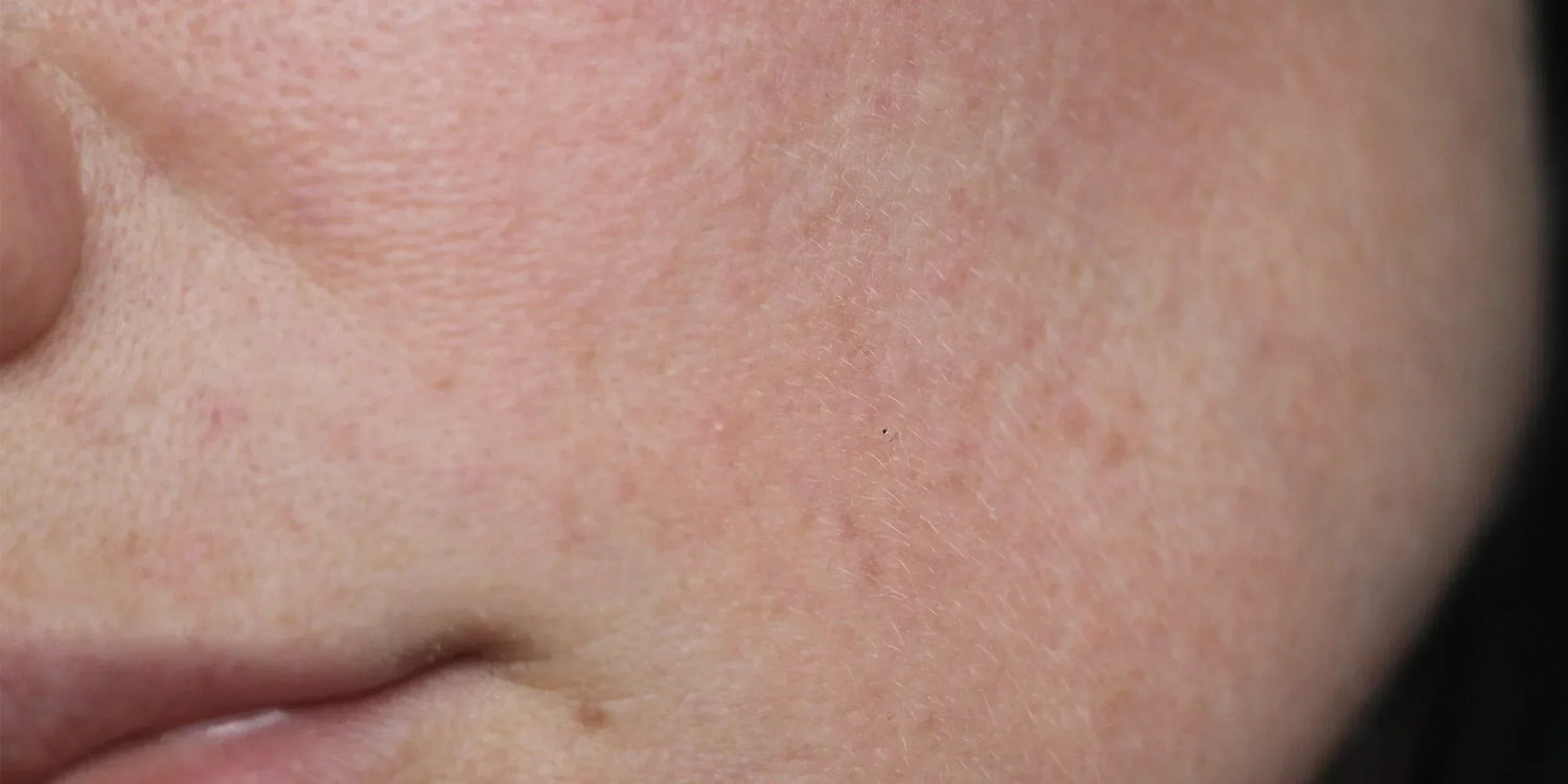 Die besten Wirkstoffe für die Hautbarriere – und was sie unterscheidet-Wonder Skin