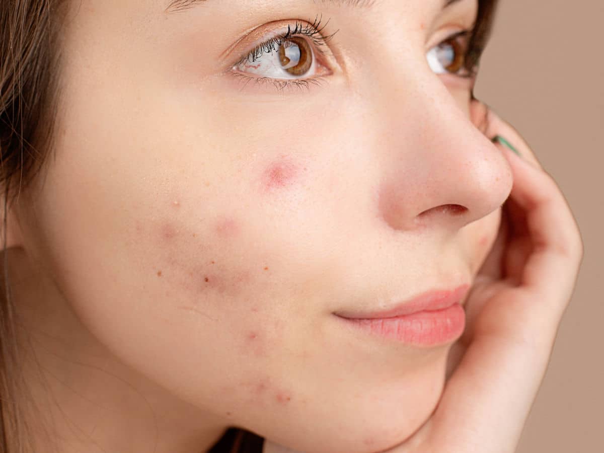 Hautbarriere wiederherstellen: Deine Routine für zuhause-Wonder Skin