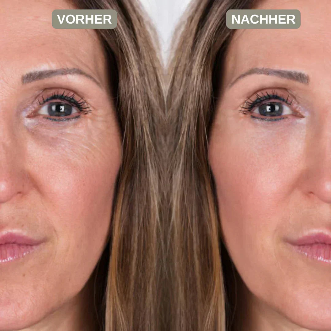 PDRN Erfahrungen: Was Frauen ab 40 wirklich berichten – und was die Wirkung bremst-Wonder Skin