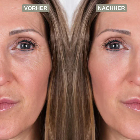 PDRN Erfahrungen: Was Frauen ab 40 wirklich berichten – und was die Wirkung bremst-Wonder Skin