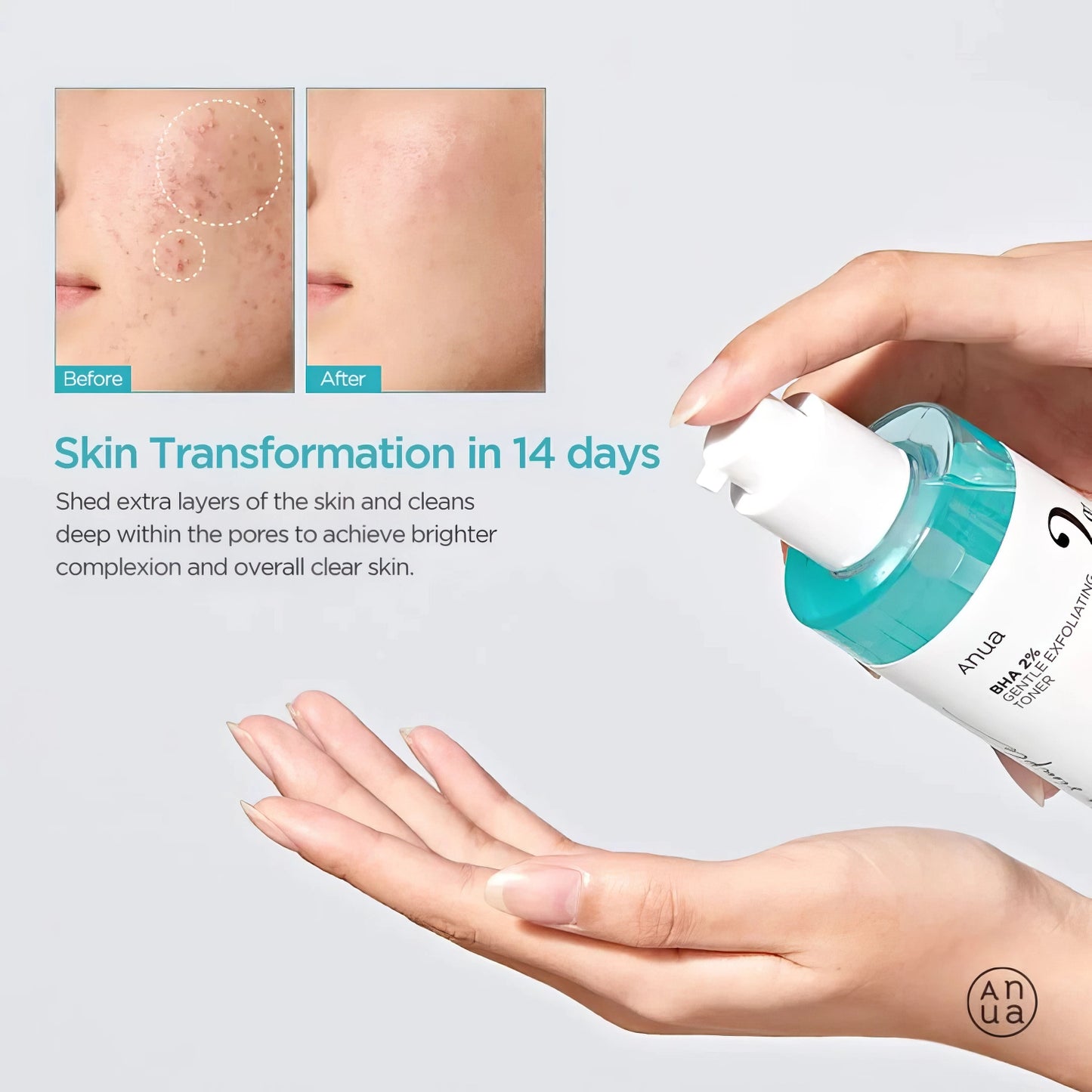 Anua BHA 2% Gentle Exfoliating Toner 150ml-Wonder Skin