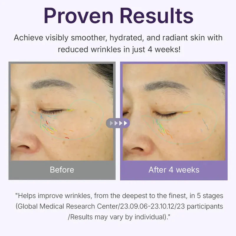 Centellian24 360 Shot PDRN Active Serum 50ml-Wonder Skin
