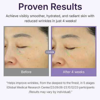 Centellian24 360 Shot PDRN Active Serum 50ml-Wonder Skin