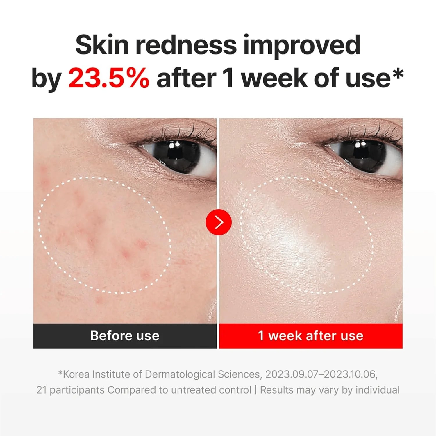 Centellian24 Madeca Cream Time Reverse 50ml-Wonder Skin