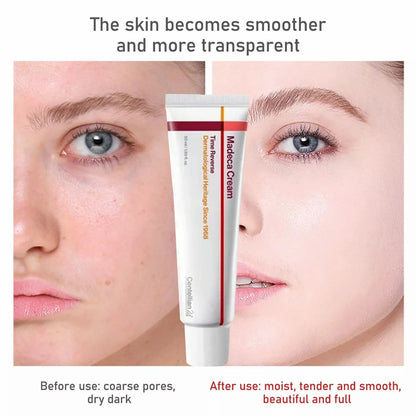 Centellian24 Madeca Cream Time Reverse 50ml-Wonder Skin
