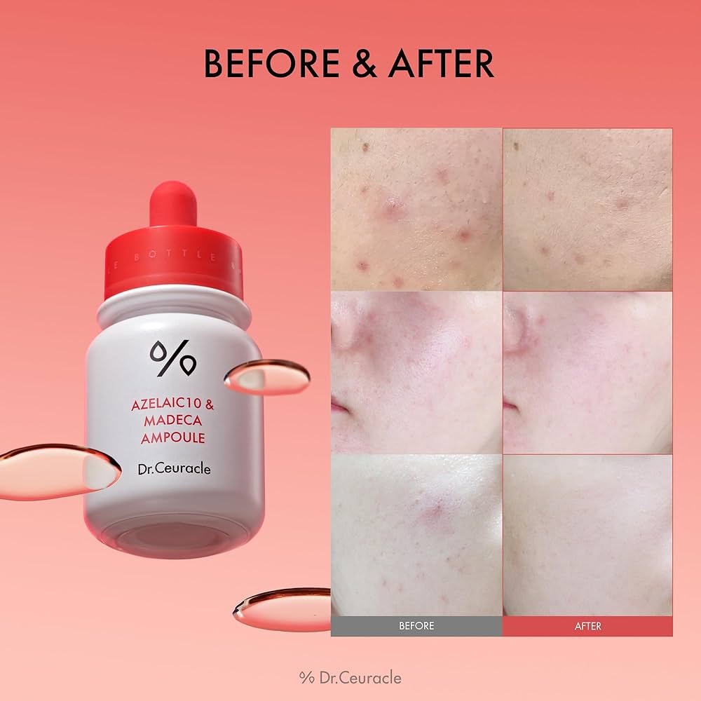 Dr. Ceuracle Azelaic 10 & Madeca Ampoule 30ml-Wonder Skin