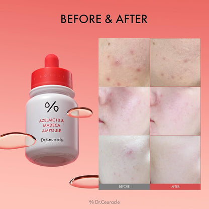 Dr. Ceuracle Azelaic 10 & Madeca Ampoule 30ml-Wonder Skin