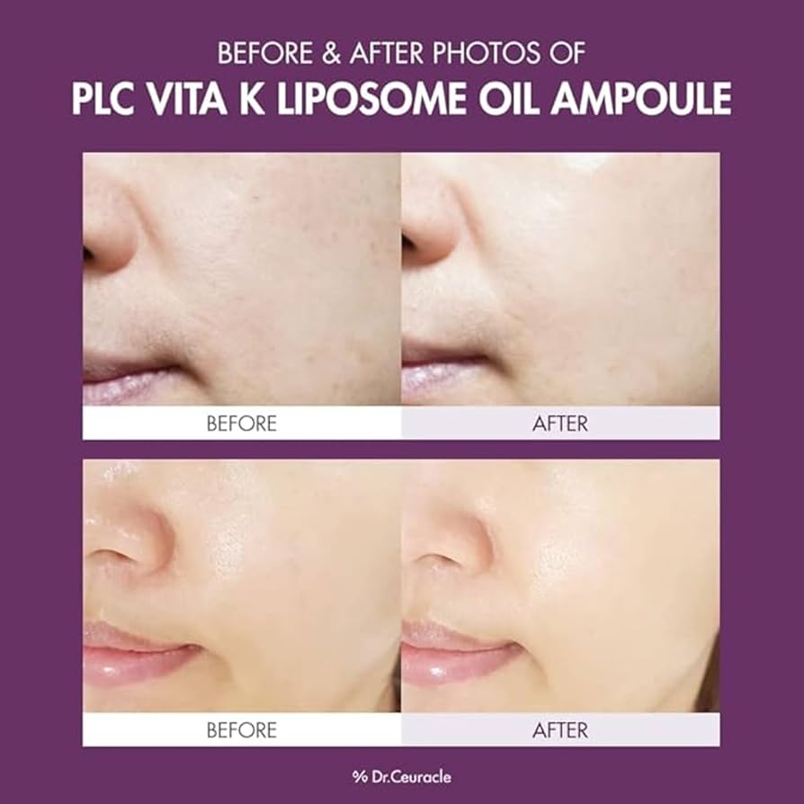 Dr. Ceuracle PLC Vita Liposome Oil Ampoule 50ml-Wonder Skin
