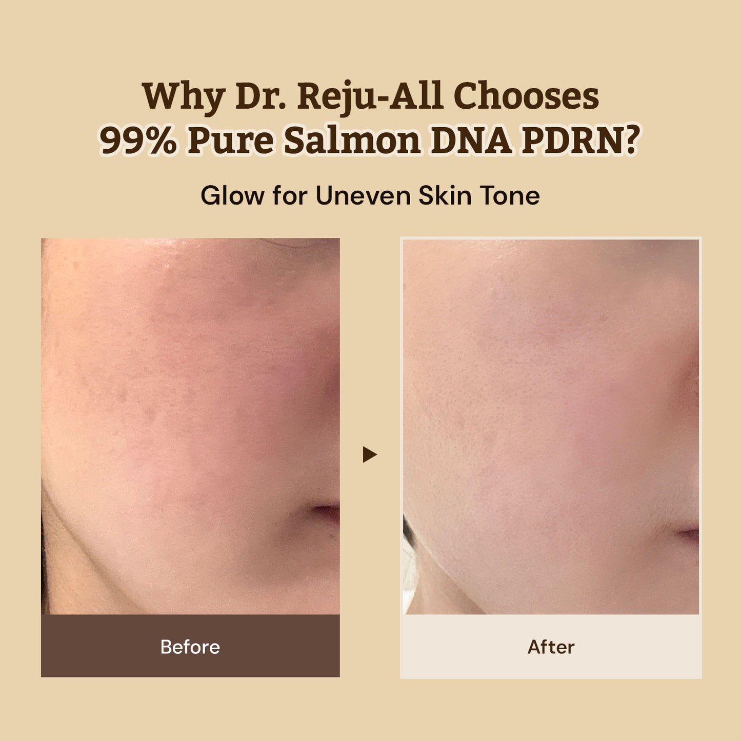 Dr. Reju-All Advanced PDRN Rejuvenating Cream 20ml-Wonder Skin