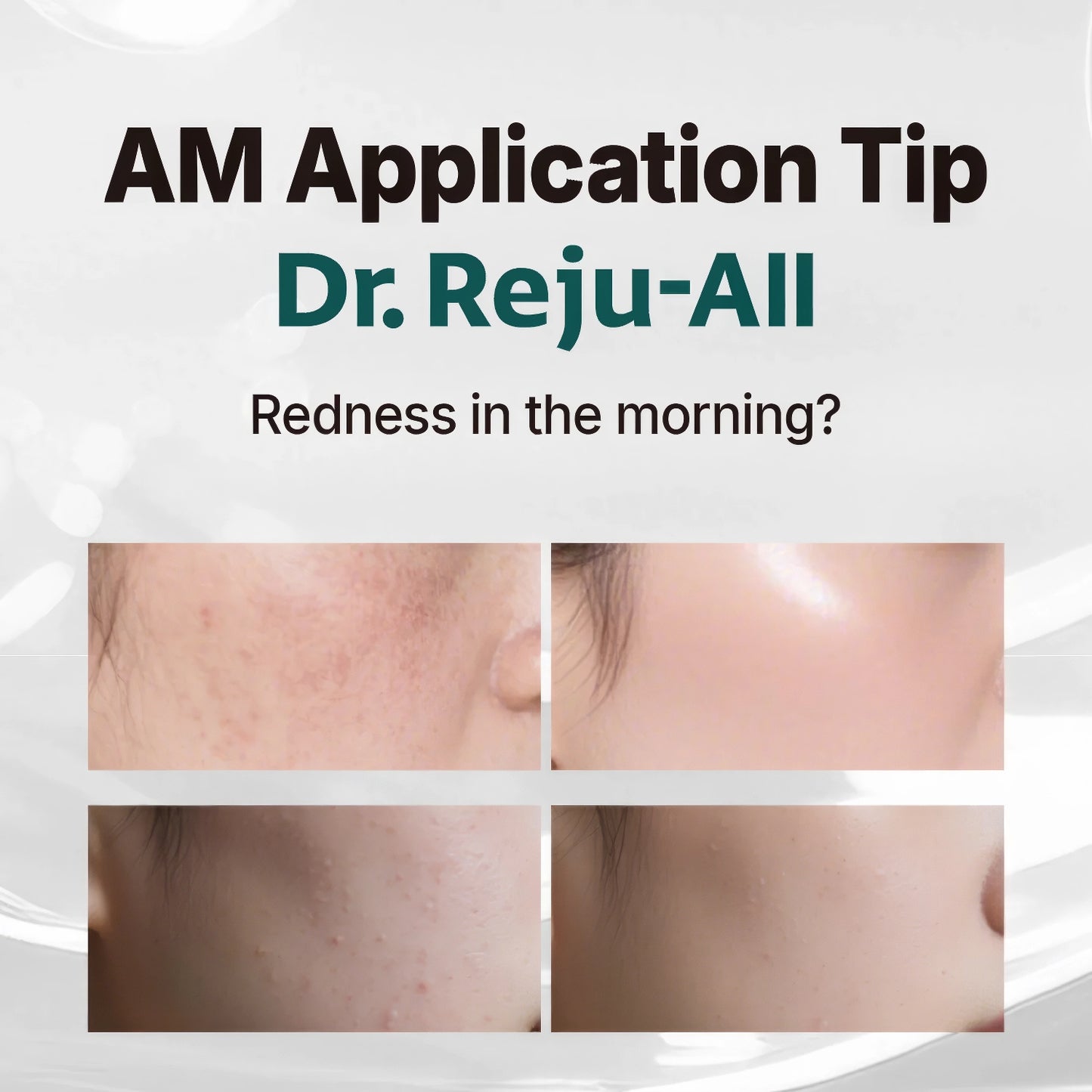 Dr. Reju-All Advanced PDRN Rejuvenating Cream 20ml-Wonder Skin