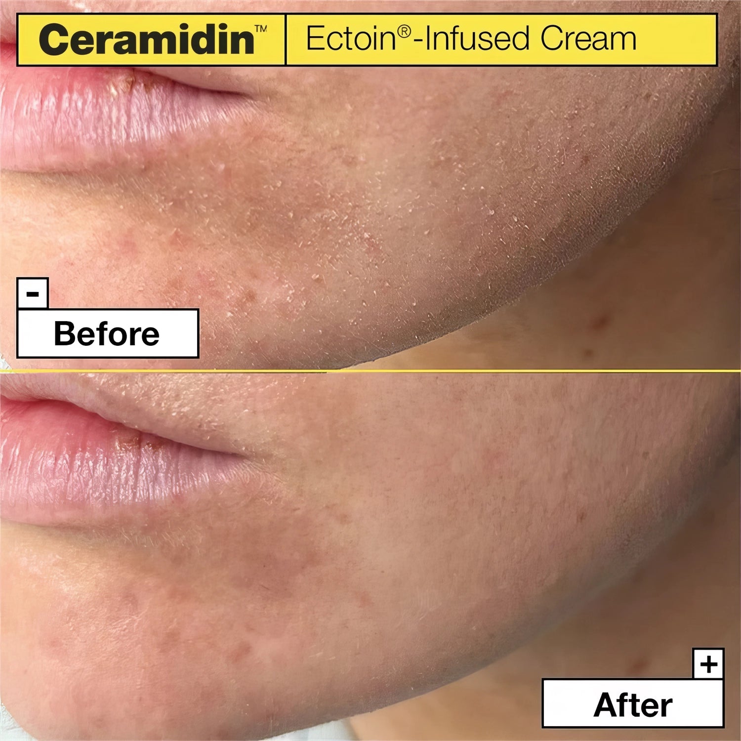 Dr.Jart+ Ceramidin Ectoin-Infused Cream 50ml-Wonder Skin