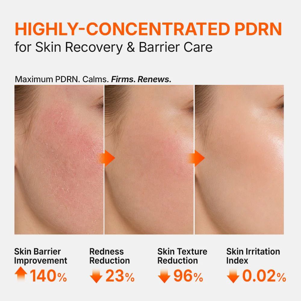 Genabelle PDRN 3% Hyper Boost Ampoule 40ml-Wonder Skin