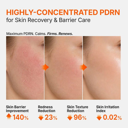 Genabelle PDRN 3% Hyper Boost Ampoule 40ml-Wonder Skin