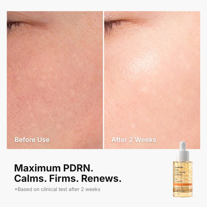 Genabelle PDRN Vita Toning Ampoule 30ml-Wonder Skin