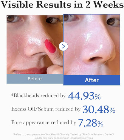 Medicube Zero Pore Pad 2.0 (70St.)-Wonder Skin