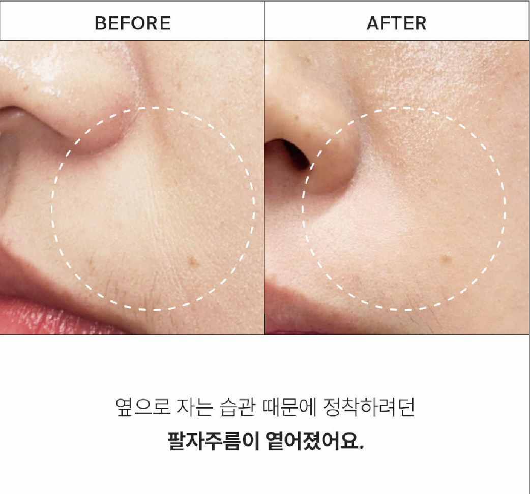 Purcell 82% High Dose Peptide Formula 30ml-Wonder Skin