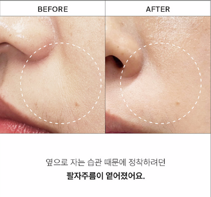 Purcell 82% High Dose Peptide Formula 30ml-Wonder Skin