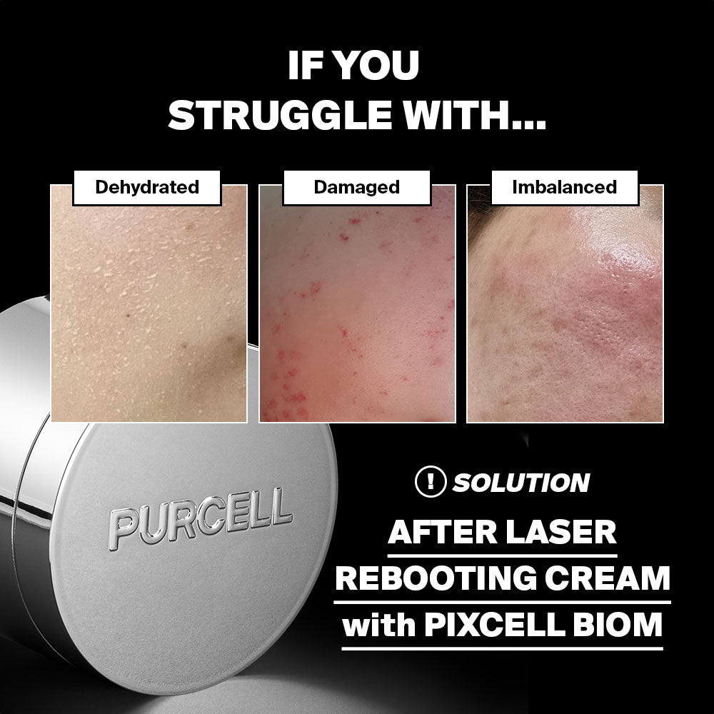 Purcell Pixcell Biom™ After Rebooting Cream 50ml-Wonder Skin