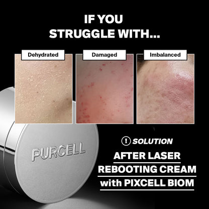 Purcell Pixcell Biom™ After Rebooting Cream 50ml-Wonder Skin